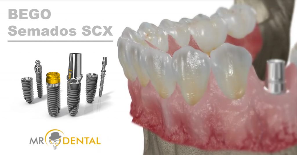 The BEGO Semados SCX implant in clinical use – MRDENTAL d.o.o. Bihać